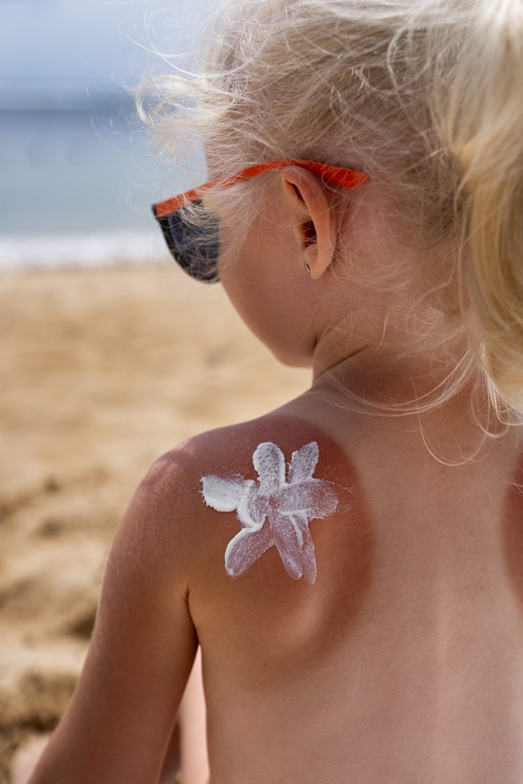 view-young-girl-beach-with-lotion-sunburn-skin